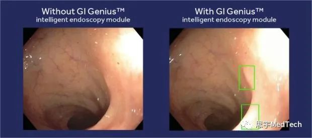 2024全球医疗科技行业十大热点(图14) 2024全球医疗科技行业十大热点(图14)