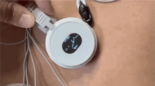 可穿戴动态心电记录仪产品检测同品种比对注